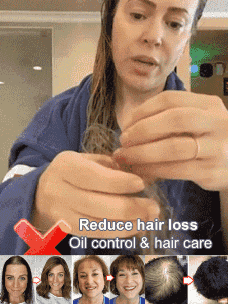 Anti-Hair Loss Hair Shampoo (70% OFF)